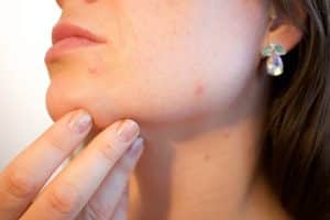 Krya Classic Facial skin balancing system: holistic skincare for oily skin