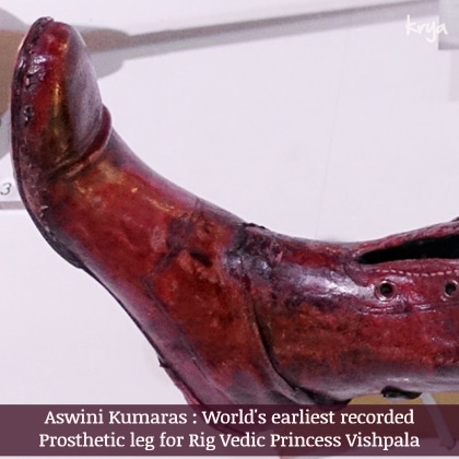 The first recorded mention of a prosthetic limb is in the Rig Veda - created by the Ashwini Kumaras