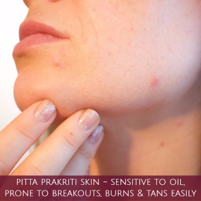 what is pitta skin